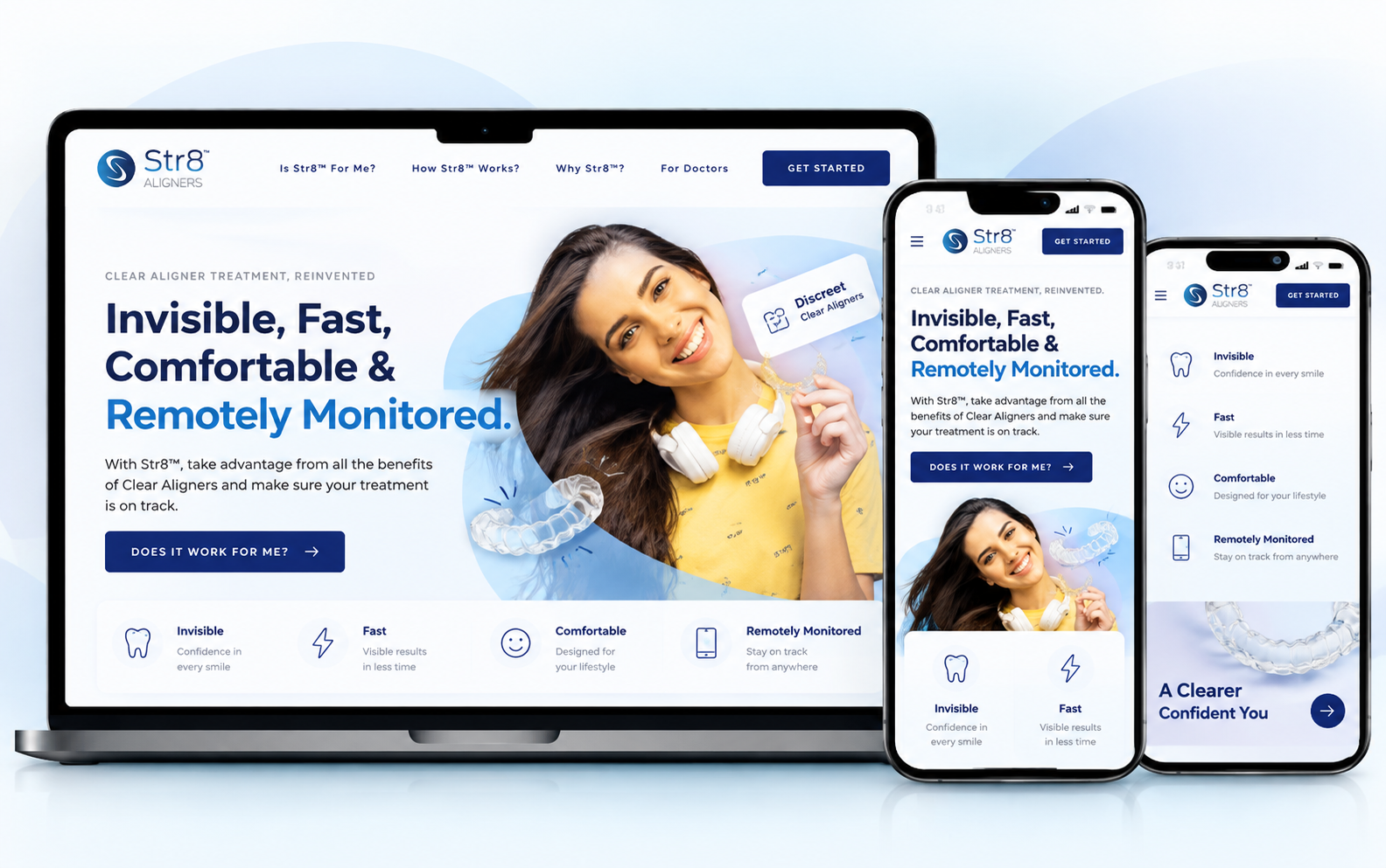 Str8 Aligners: keeping orthodontic treatment on track between visits
